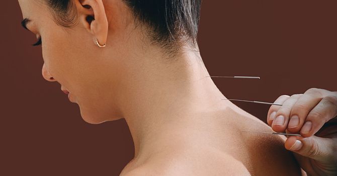 Laser Acupuncture